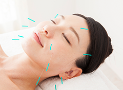 鍼を刺すことでの美容効果